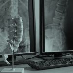 Medical negligence win against chiropractor