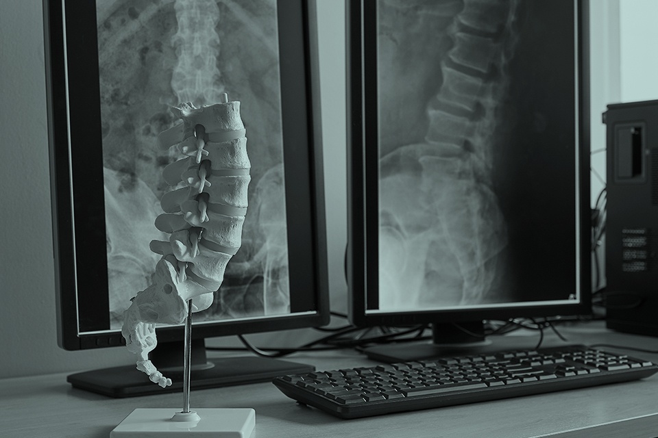 Medical negligence win against chiropractor